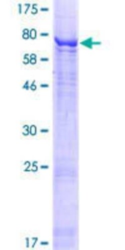 Novus Biologicals Recombinant Human WDR51B GST (N-Term) Protein 25 &mu;g | Buy Online | Novus Biologicals&trade; | Fisher Scientific