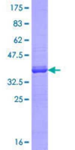Novus Biologicals Recombinant Human P4HA3 GST (N-Term) Protein 25 &mu;g | Buy Online | Novus Biologicals&trade; | Fisher Scientific