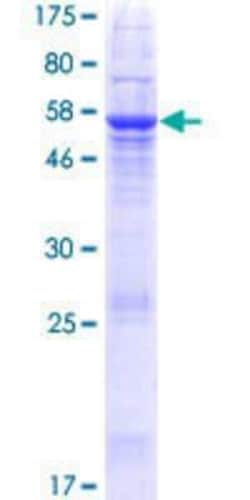 Novus Biologicals Recombinant Human SLC22A24 GST (N-Term) Protein 10 &mu;g | Buy Online | Novus Biologicals&trade; | Fisher Scientific