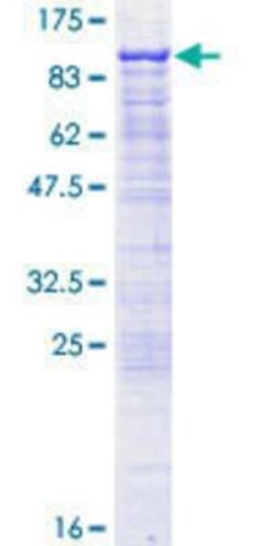 Novus Biologicals Recombinant Human GAS2L3 GST (N-Term) Protein 10 &mu;g | Buy Online | Novus Biologicals&trade; | Fisher Scientific