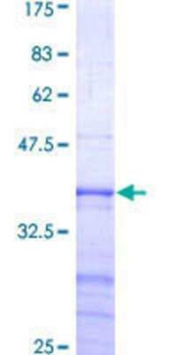 Novus Biologicals Recombinant Human GAS2L3 GST (N-Term) Protein 10 &mu;g | Buy Online | Novus Biologicals&trade; | Fisher Scientific