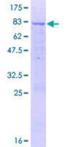 Novus Biologicals Recombinant Human HEL-206 GST (N-Term) Protein 10 &mu;g | Buy Online | Novus Biologicals&trade; | Fisher Scientific