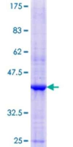 Novus Biologicals Recombinant Human NOMO2 GST (N-Term) Protein 10 &mu;g | Buy Online | Novus Biologicals&trade; | Fisher Scientific