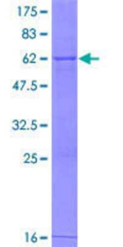Novus Biologicals Recombinant Human GDPD1 GST (N-Term) Protein 10 &mu;g | Buy Online | Novus Biologicals&trade; | Fisher Scientific