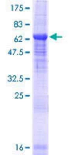 Novus Biologicals Recombinant Human BTBD8 GST (N-Term) Protein 25 &mu;g | Buy Online | Novus Biologicals&trade; | Fisher Scientific