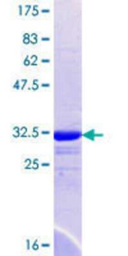 Novus Biologicals Recombinant Human SLC9A9 GST (N-Term) Protein 25 &mu;g | Buy Online | Novus Biologicals&trade; | Fisher Scientific