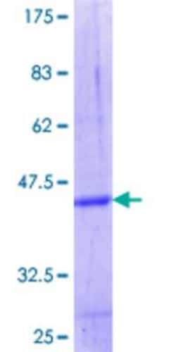 Novus Biologicals Recombinant Human FBXW12 GST (N-Term) Protein 10 &mu;g | Buy Online | Novus Biologicals&trade; | Fisher Scientific