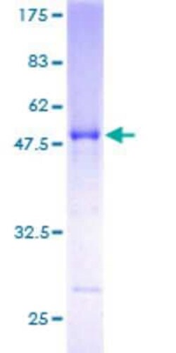 Novus Biologicals Recombinant Human RABL3 GST (N-Term) Protein 25 &mu;g | Buy Online | Novus Biologicals&trade; | Fisher Scientific