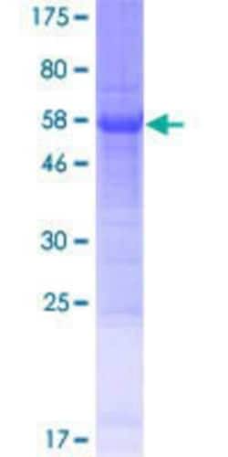 Novus Biologicals Recombinant Human C3orf70 GST (N-Term) Protein 25 &mu;g | Buy Online | Novus Biologicals&trade; | Fisher Scientific
