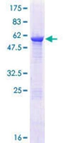 Novus Biologicals Recombinant Human C5orf51 GST (N-Term) Protein 10 &mu;g | Buy Online | Novus Biologicals&trade; | Fisher Scientific