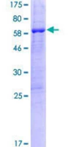 Novus Biologicals&trade;&nbsp;Recombinant Human PPIL6 GST (N-Term) Protein