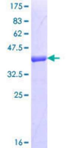 Novus Biologicals Recombinant Human F-box protein 43 GST (N-Term) Protein 10 &mu;g | Buy Online | Novus Biologicals&trade; | Fisher Scientific