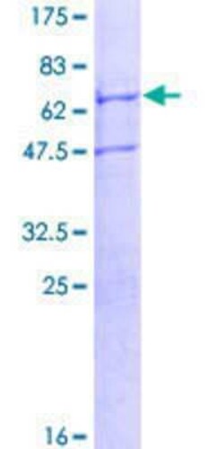Novus Biologicals Recombinant Human TRIM59 GST (N-Term) Protein 10 &mu;g | Buy Online | Novus Biologicals&trade; | Fisher Scientific