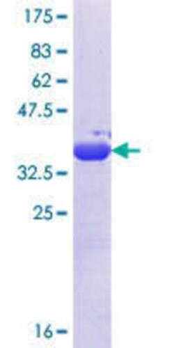 Novus Biologicals Recombinant Human POTED GST (N-Term) Protein 10 &mu;g | Buy Online | Novus Biologicals&trade; | Fisher Scientific