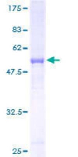 Novus Biologicals Recombinant Human RAB37 GST (N-Term) Protein 25 &mu;g | Buy Online | Novus Biologicals&trade; | Fisher Scientific