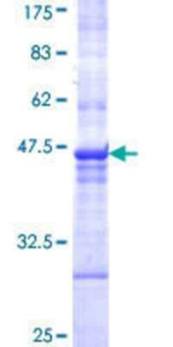 Novus Biologicals Recombinant Human PPM1J GST (N-Term) Protein 10 &mu;g | Buy Online | Novus Biologicals&trade; | Fisher Scientific