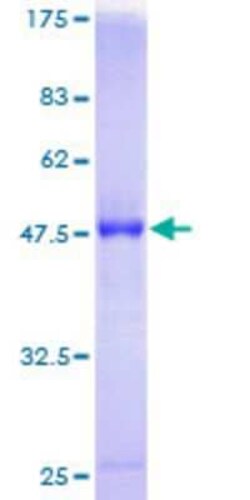 Novus Biologicals Recombinant Human RAB7B GST (N-Term) Protein 25 &mu;g | Buy Online | Novus Biologicals&trade; | Fisher Scientific