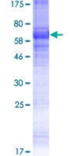 Novus Biologicals Recombinant Human KCNK18 GST (N-Term) Protein 25 &mu;g | Buy Online | Novus Biologicals&trade; | Fisher Scientific