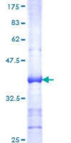 Novus Biologicals Recombinant Human RAB43 GST (N-Term) Protein 10 &mu;g | Buy Online | Novus Biologicals&trade; | Fisher Scientific