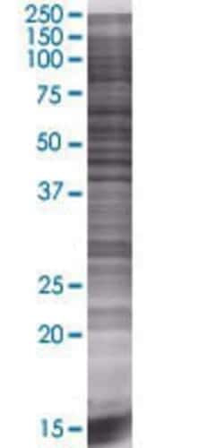 Novus Biologicals&trade;&nbsp;ENPP-7/Alk-SMase 293T Cell Transient Overexpression Lysate