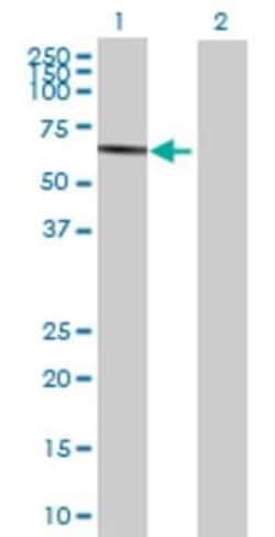 Novus Biologicals ENPP-7/Alk-SMase 293T Cell Transient Overexpression Lysate 0.1 mL | Buy Online | Novus Biologicals&trade; | Fisher Scientific