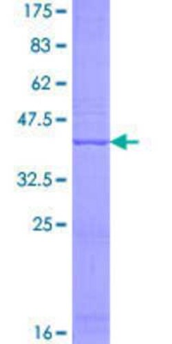 Novus Biologicals Recombinant Human NAT8L GST (N-Term) Protein 10 &mu;g | Buy Online | Novus Biologicals&trade; | Fisher Scientific