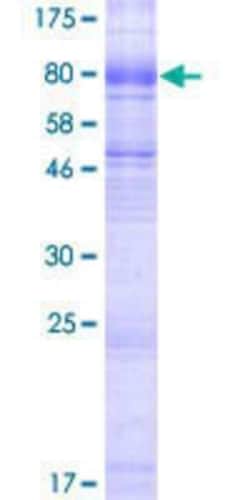 Novus Biologicals Recombinant Human SLC6A19 GST (N-Term) Protein 2 &mu;g | Buy Online | Novus Biologicals&trade; | Fisher Scientific