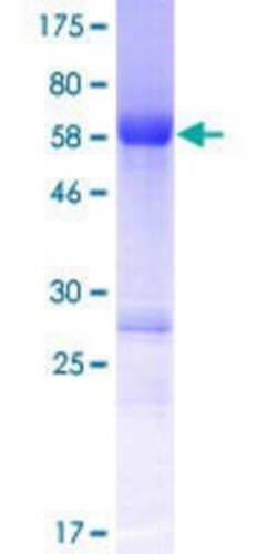 Novus Biologicals Recombinant Human SMTNL2 GST (N-Term) Protein 10 &mu;g | Buy Online | Novus Biologicals&trade; | Fisher Scientific