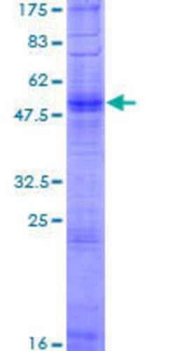 Novus Biologicals Recombinant Human OR2W3 GST (N-Term) Protein 2 &mu;g | Buy Online | Novus Biologicals&trade; | Fisher Scientific