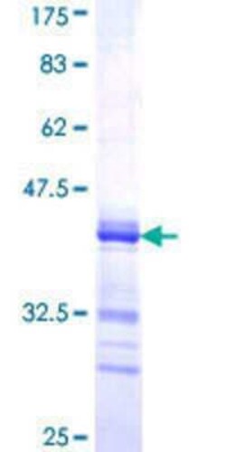 Novus Biologicals Recombinant Human BARHL2 GST (N-Term) Protein 10 &mu;g | Buy Online | Novus Biologicals&trade; | Fisher Scientific