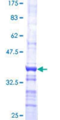 Novus Biologicals Recombinant Human CDKL4 GST (N-Term) Protein 10 &mu;g | Buy Online | Novus Biologicals&trade; | Fisher Scientific