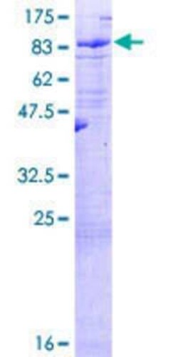 Novus Biologicals Recombinant Human LRIT3 GST (N-Term) Protein 25 &mu;g | Buy Online | Novus Biologicals&trade; | Fisher Scientific
