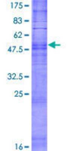 Novus Biologicals Recombinant Human OR2A12 GST (N-Term) Protein 2 &mu;g | Buy Online | Novus Biologicals&trade; | Fisher Scientific