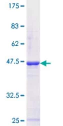 Novus Biologicals Recombinant Human ZNF81 GST (N-Term) Protein 10 &mu;g | Buy Online | Novus Biologicals&trade; | Fisher Scientific