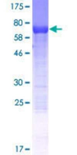 Novus Biologicals Recombinant Human EP400NL GST (N-Term) Protein 25 &mu;g | Buy Online | Novus Biologicals&trade; | Fisher Scientific