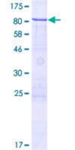 Novus Biologicals Recombinant Human ZNF530 GST (N-Term) Protein 2 &mu;g | Buy Online | Novus Biologicals&trade; | Fisher Scientific