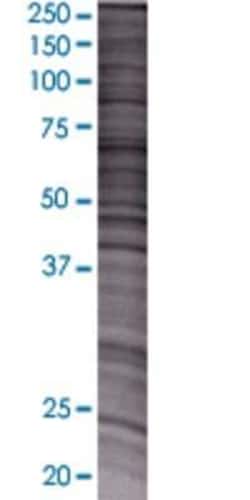 Novus Biologicals&trade;&nbsp;NMNAT3 293T Cell Transient Overexpression Lysate