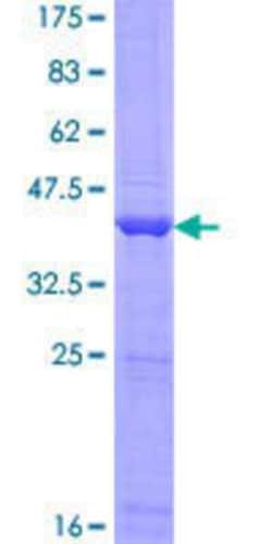 Novus Biologicals Recombinant Human ANKRD37 GST (N-Term) Protein 25 &mu;g | Buy Online | Novus Biologicals&trade; | Fisher Scientific