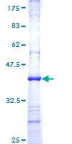 Novus Biologicals Recombinant Human NDUFS7 GST (N-Term) Protein 25 &mu;g | Buy Online | Novus Biologicals&trade; | Fisher Scientific