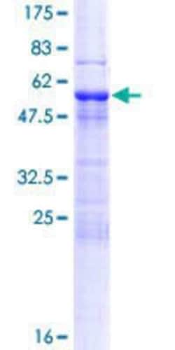 Novus Biologicals Recombinant Human MAST4 GST (N-Term) Protein 25 &mu;g | Buy Online | Novus Biologicals&trade; | Fisher Scientific