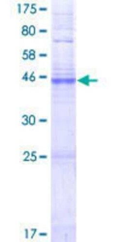 Novus Biologicals Recombinant Human Connexin 25/GJB7 GST (N-Term) Protein 2 &mu;g | Buy Online | Novus Biologicals&trade; | Fisher Scientific