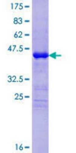 Novus Biologicals&trade;&nbsp;Recombinant Human Cysteine Rich Tail 1 GST (N-Term) Protein