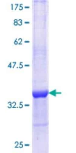 Novus Biologicals Recombinant Human FATP1/SLC27A1 GST (N-Term) Protein 10 &mu;g | Buy Online | Novus Biologicals&trade; | Fisher Scientific