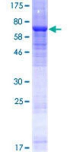 Novus Biologicals Recombinant Human ENTPD8 GST (N-Term) Protein 25 &mu;g | Buy Online | Novus Biologicals&trade; | Fisher Scientific