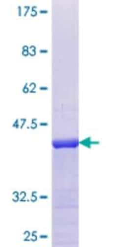 Novus Biologicals Recombinant Human APITD1 GST (N-Term) Protein 25 &mu;g | Buy Online | Novus Biologicals&trade; | Fisher Scientific
