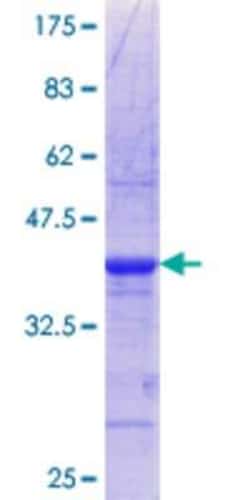 Novus Biologicals Recombinant Human NHLRC1 GST (N-Term) Protein 25 &mu;g | Buy Online | Novus Biologicals&trade; | Fisher Scientific