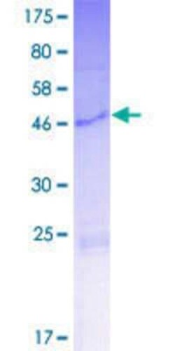 Novus Biologicals Recombinant Human KRTAP10-2 GST (N-Term) Protein 2 &mu;g | Buy Online | Novus Biologicals&trade; | Fisher Scientific
