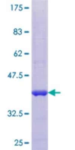 Novus Biologicals Recombinant Human SUMO4 GST (N-Term) Protein 10 &mu;g | Buy Online | Novus Biologicals&trade; | Fisher Scientific