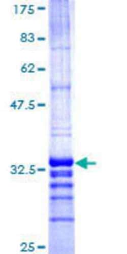 Novus Biologicals Recombinant Human Kua-UEV GST (N-Term) Protein 25 &mu;g | Buy Online | Novus Biologicals&trade; | Fisher Scientific