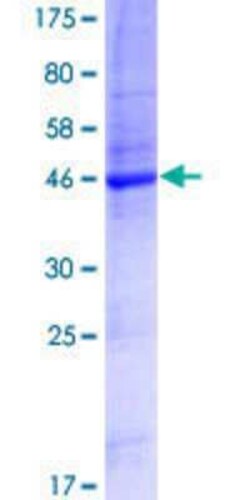 Novus Biologicals Recombinant Human TMEM179 GST (N-Term) Protein 25 &mu;g | Buy Online | Novus Biologicals&trade; | Fisher Scientific